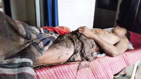 युवक आया गाज की चपेट में, परिजनों ने गोबर से ढक दिया, मौत