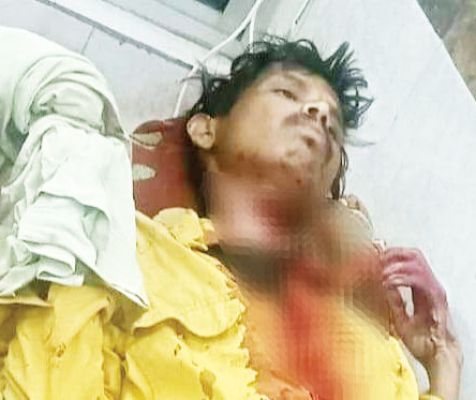 पत्नी मायके गई, परेशान पति ने काटा खुद का गला, गंभीर
