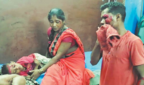 बाइक के सामने आया कुत्ता, मासूम समेत 4 जख्मी