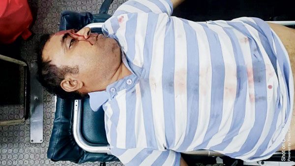 अडानी कंपनी के डीजीएम  की सडक़ हादसे में मौत 