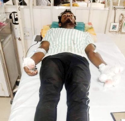 बम विस्फोट में घायल 2 ग्रामीण मेकाज लाये गए