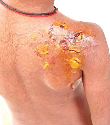 कुत्तों का आतंक, तीन मासूम हुए घायल