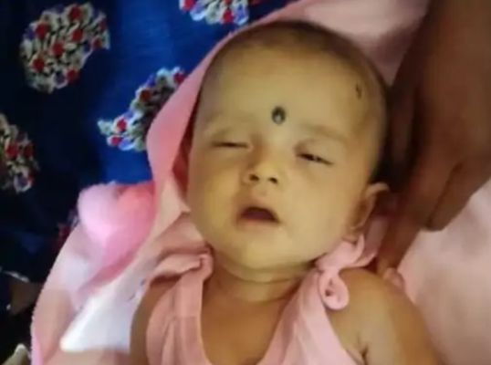 टीकाकरण के बाद दो माह की बच्ची की मौत, परिजनों ने किया कलेक्ट्रेट में प्रदर्शन