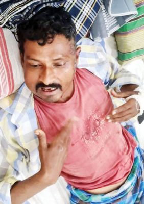 अस्पताल में घायल के 7 हजार चोरी सफाईकर्मी पर चुराने का आरोप