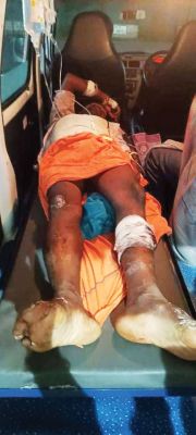  करंट की चपेट में युवक झुलसा, सूअर पकडऩे लगाया था करंट