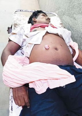 छछानपैरी में हत्या, चाकू मार अतड़ी बाहर निकाला