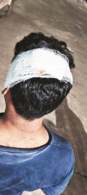 भाटापारा में युवा कांग्रेस महासचिव पर हमला पुलिस कार्रवाई को लेकर कई आरोप