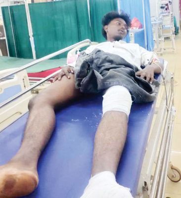 ट्रक को ओवरटेक करते पिकअप से बाइक की टक्कर