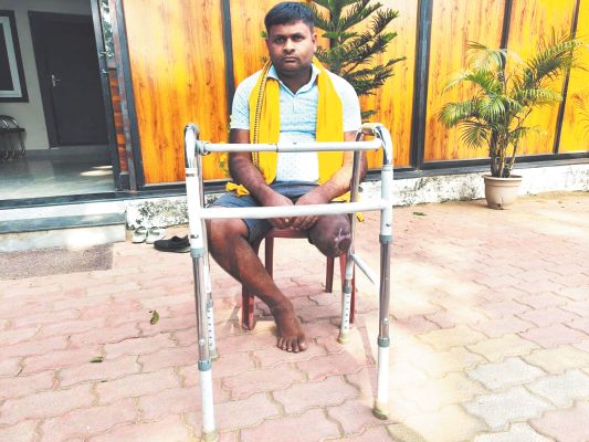 पुरेन्द्र का रायपुर में लगेगा नया कृत्रिम पैर