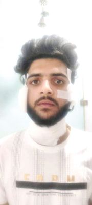 यश हत्याकांड के गवाह को जेल में मारा ब्लेड, सभी आरोपी सजा काट रहे