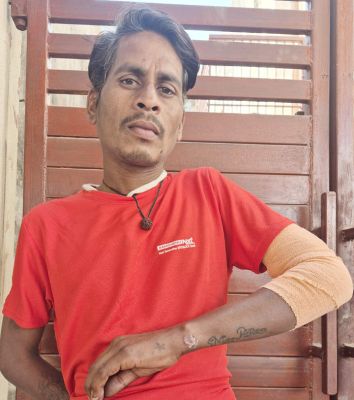 युवक के साथ मारपीट और  जलाने के आरोप, जांच शुरू