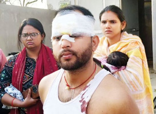 स्कॉर्पियो ने बाइक को मारी टक्कर, दो शिक्षक जख्मी