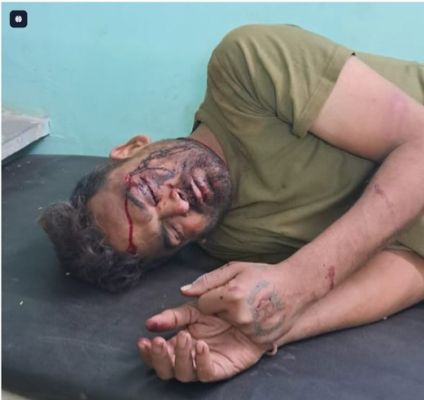 भतीजे को बचाने पहुंचे फौजी को रॉड से पीटा, गंभीर हालत में सिम्स में भर्ती