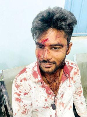 कांशीराम नगर में हाफ मर्डर, सिलतरा ढाबे में तोडफ़ोड़- मारपीट