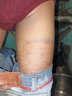 बकाया मजदूरी मांगने पहुंचे मजदूर से विवाद-मारपीट, मामला दर्ज
