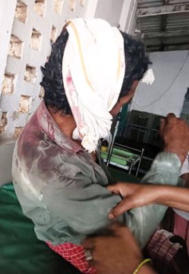 विवाद में बीच-बचाव करना पड़ा भारी, टांगी से हमला