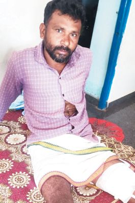 जंगली सुअर के हमले से किसान जख्मी