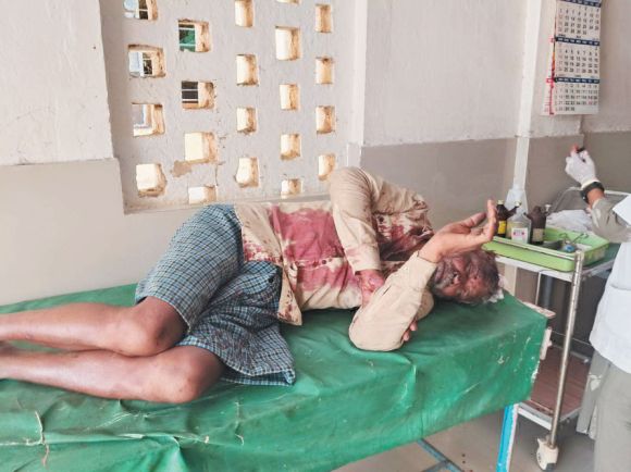 जमीन बंटवारे पर विवाद, बेटे पर हमला